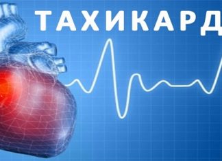 Разумни синусова тахикардия