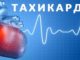 Разумни синусова тахикардия