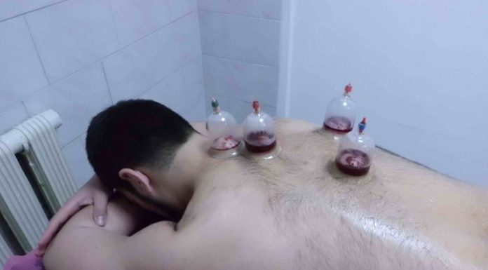 Хиджама от налягане