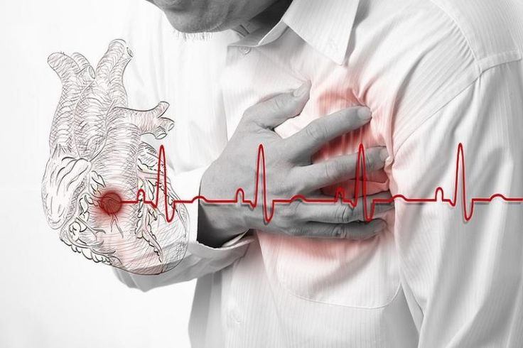 Често сърцебиене при нормално налягане