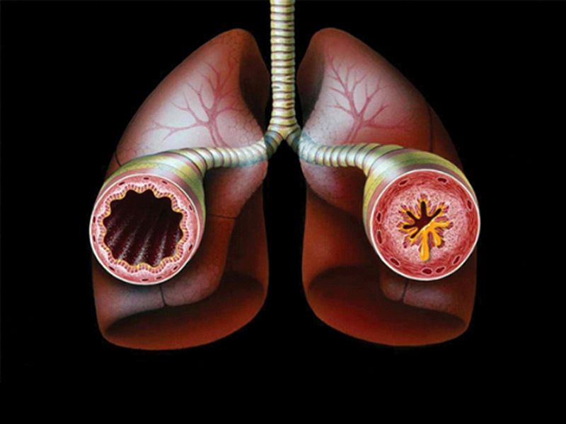 Аритмия при астма