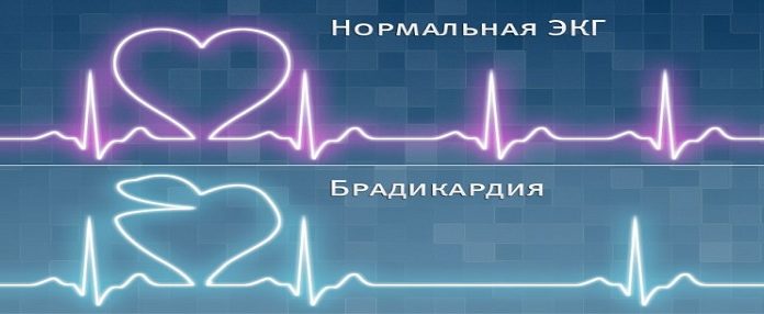 Ускорен сърдечен ритъм и брадикардия