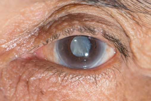 Лечение на глаукома с лекарства